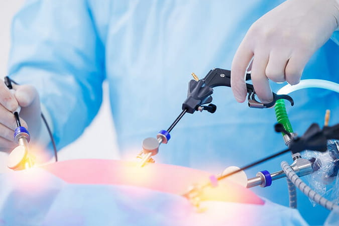 Лапароскопическая холецистэктомия